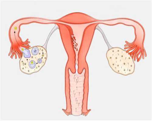 自然周期移植后需要补雌二醇吗多久能怀孕